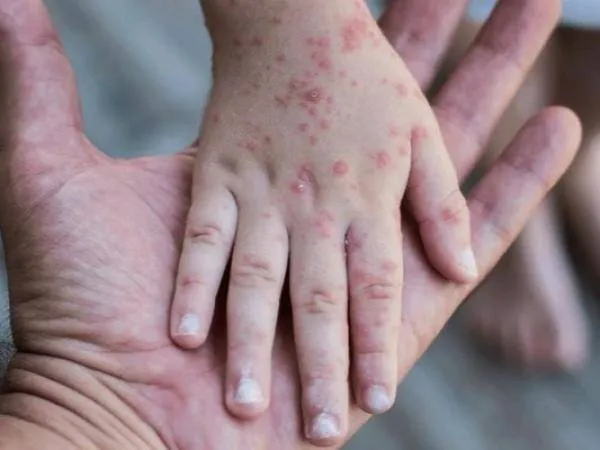 570475451_122141541734898185_798967007911853795_n